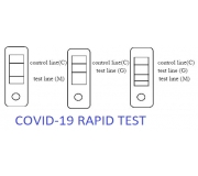 COVID-19 (SARS-CoV-2) RAPID ANTIBODY TEST IgM and IgE Detection - FOR RESEARCH USE ONLY - NOT FOR DIAGNOSTICS (Part CV-ab)